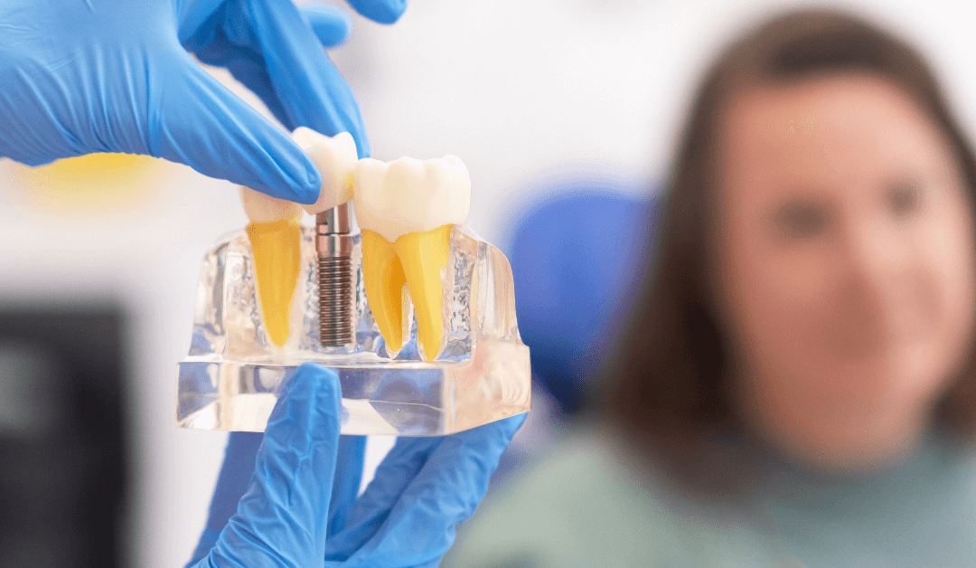 The Importance of Restoring Missing Teeth: Why Dental Implants Matter