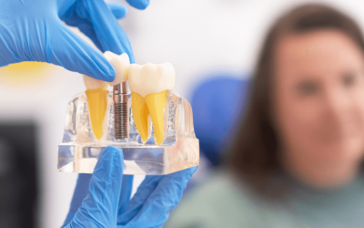 The Importance of Restoring Missing Teeth: Why Dental Implants Matter